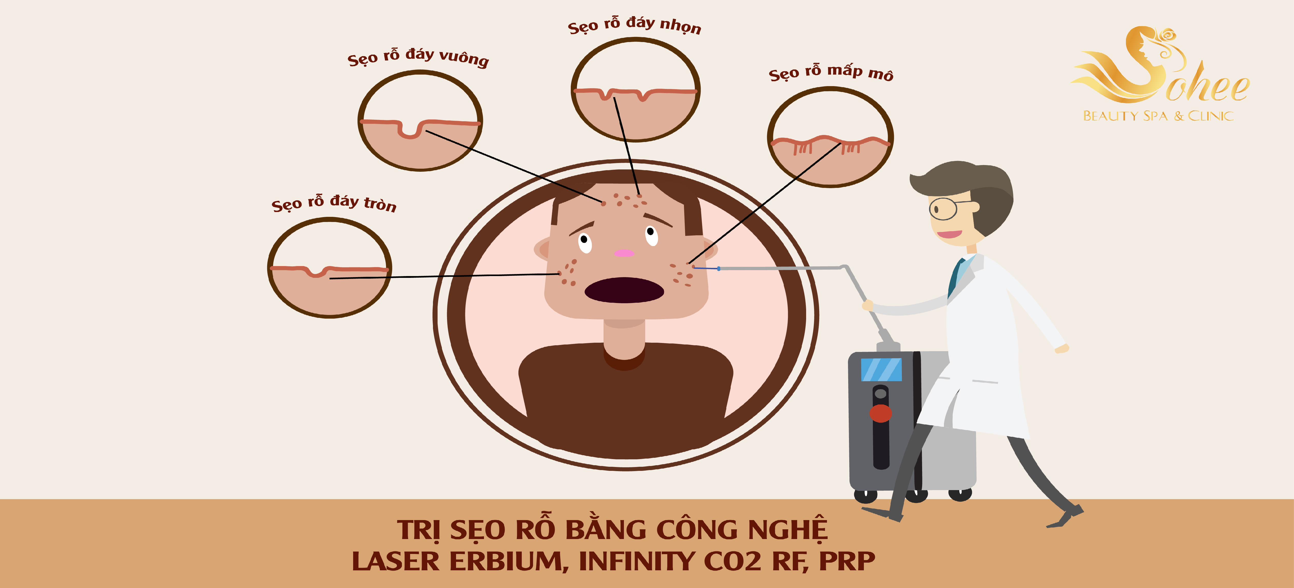 cover-dieu-tri-seo-ro-10-08-2018-15-22-33.jpg
