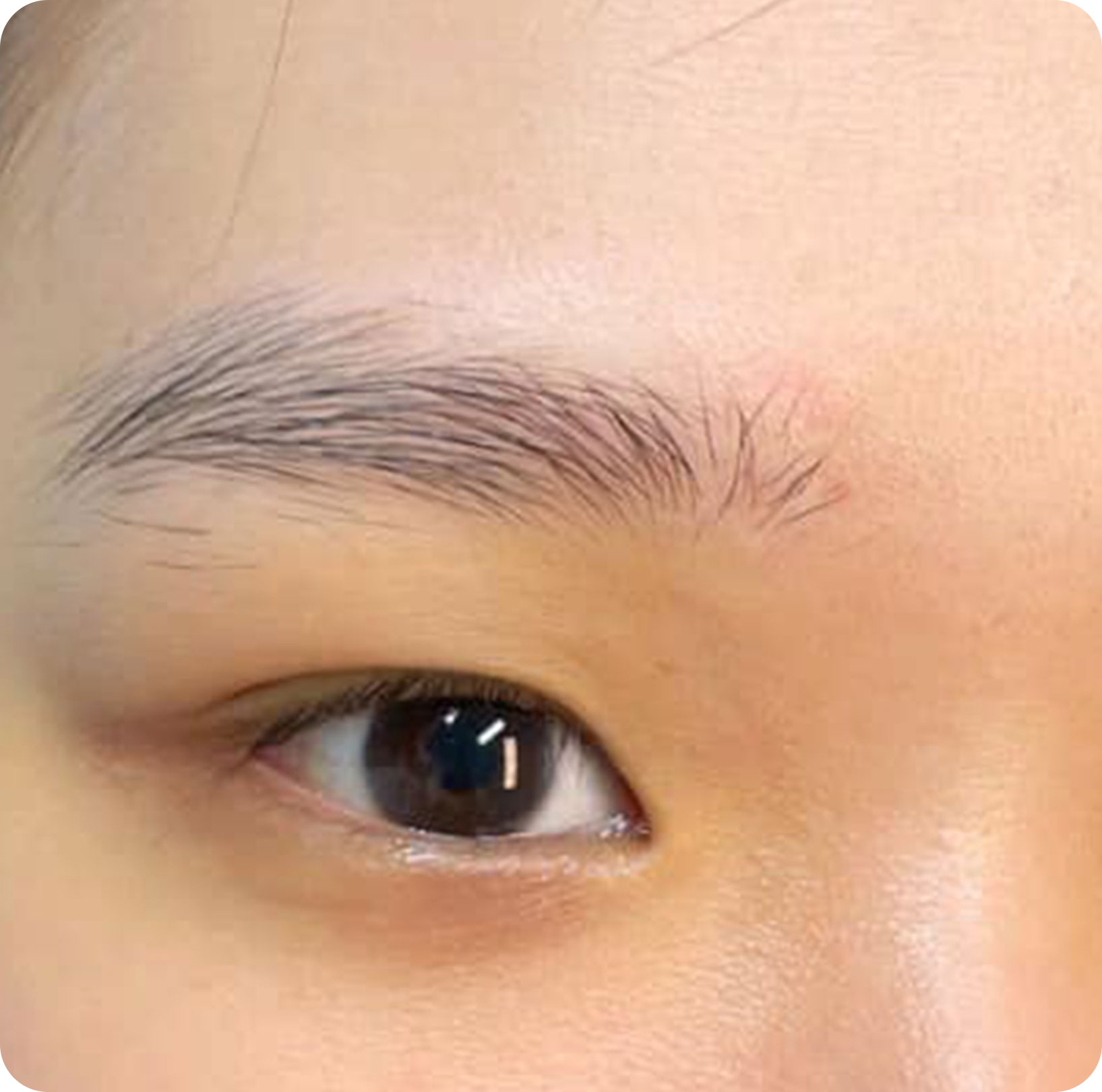 Người có chân mày thưa, nhạt hoặc chân mày ngắn, thiếu đuôi chân mày. Người có chân mày thưa, nhạt hoặc chân mày ngắn, thiếu đuôi chân mày.