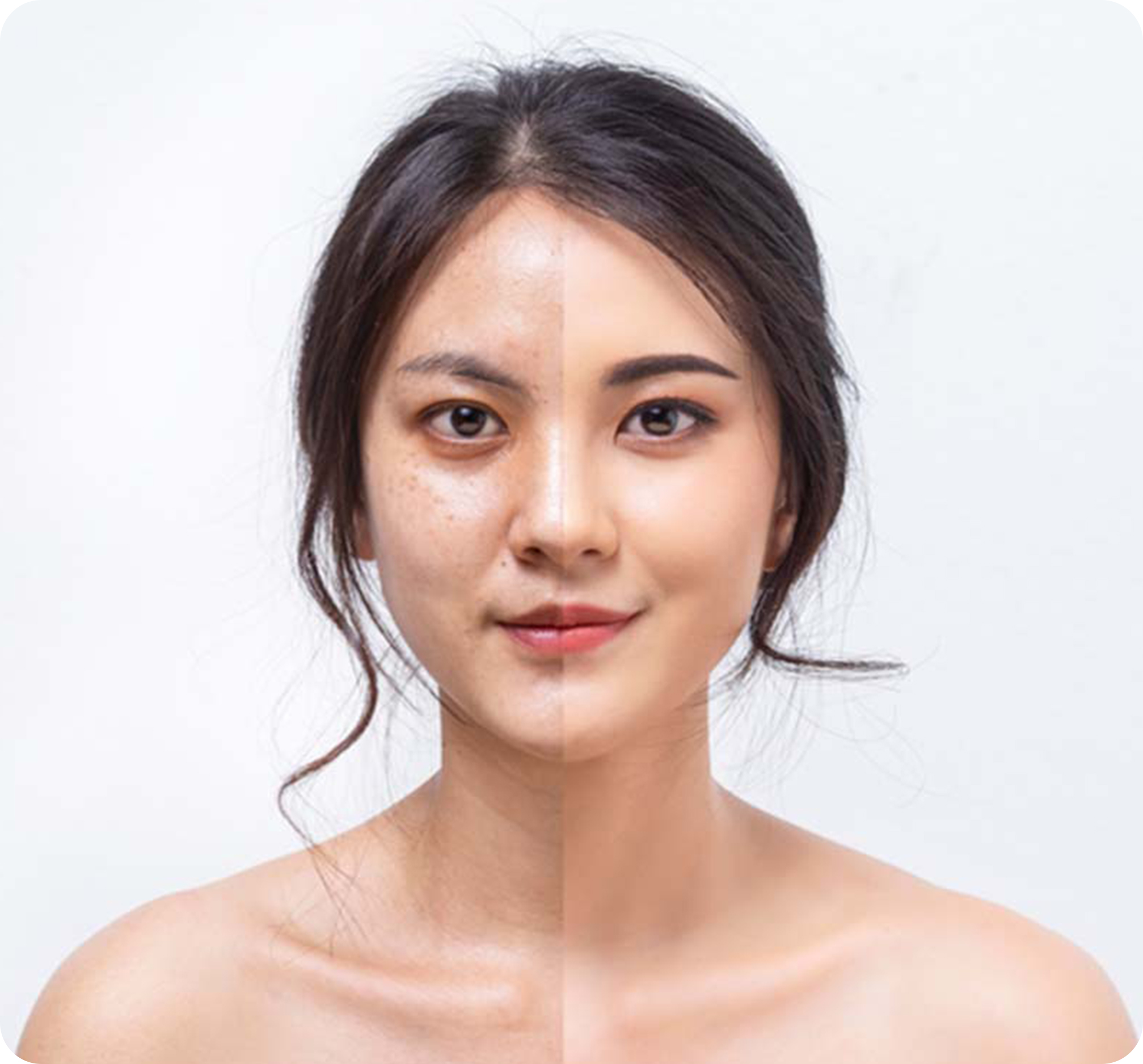 ĐẨY LÙI 80% GỐC NÁM TÀN NHANG CHỈ SAU 1 LIỆU TRÌNH ĐẨY LÙI 80% GỐC NÁM TÀN NHANG CHỈ SAU 1 LIỆU TRÌNH