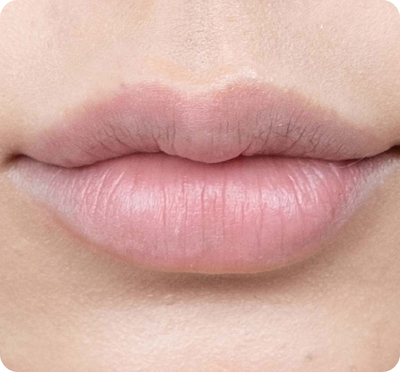 Người có đôi môi nhợt nhạt, môi bị thâm bẩm sinh hoặc do dùng son thường xuyên. Người có đôi môi nhợt nhạt, môi bị thâm bẩm sinh hoặc do dùng son thường xuyên.